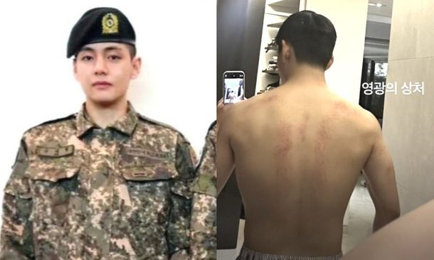 BTS’s V Reveals Angry Back Muscles