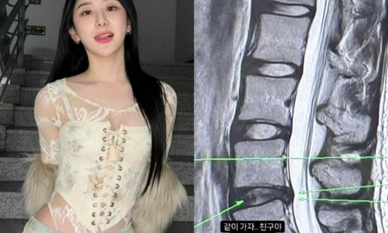lee chaeyeon thumbnail