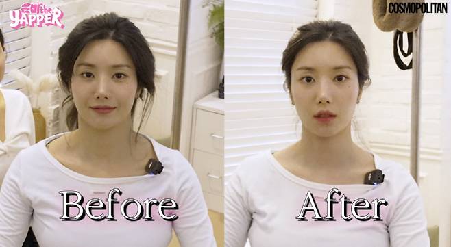 Kwon Eun-bi Reveals Before-and-After Treatment Photos