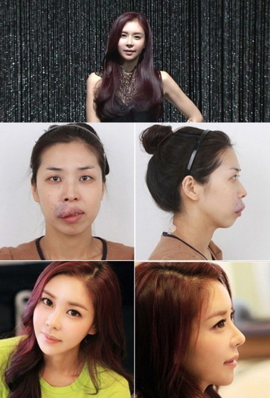 Korean Plastic Surgery Show Make Me Girl