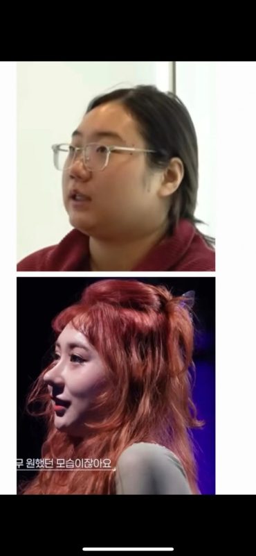 Korean Plastic Surgery Show Make Me Girl