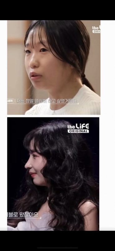 Korean Plastic Surgery Show Make Me Girl