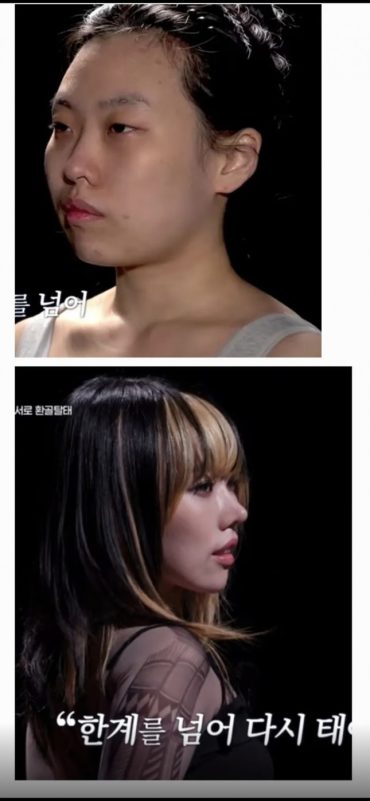 Korean Plastic Surgery Show Make Me Girl