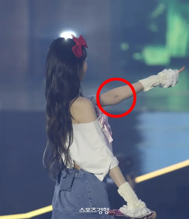 Fans Express Growing Concerns Over IVE's Jang Wonyoung's Health 1