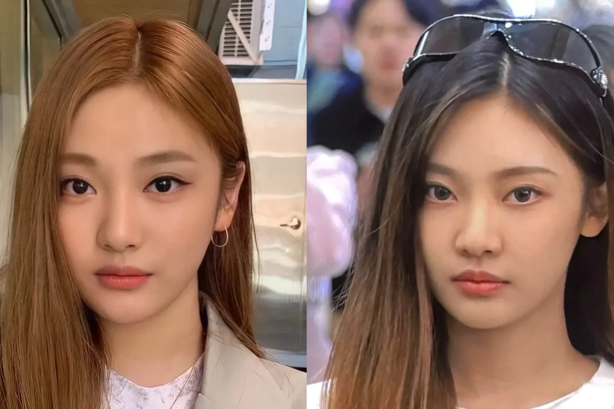 ningning-plastic-surgery-rumors-thumbnail
