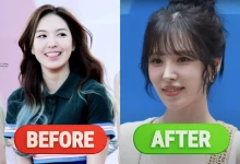 wendy-plastic-surgery-rumors-thumbnail