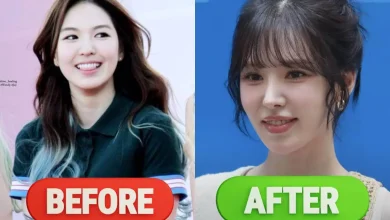 wendy-plastic-surgery-rumors-thumbnail