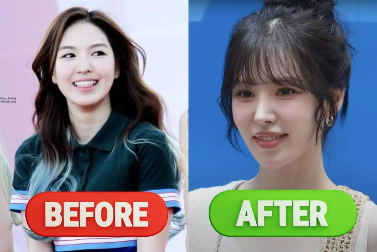 wendy-plastic-surgery-rumors-thumbnail