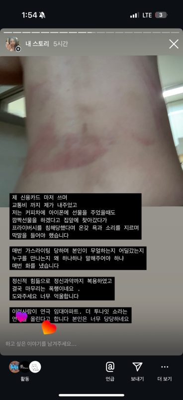 Musical Actor Jeon Ho-joon Accused of Shocking Assault by Former Girlfriend in Online Post 6