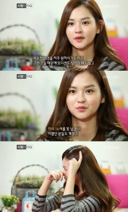 Kim Yoon-hye jaw surgery transformationwoman-brunette-expression-interview.