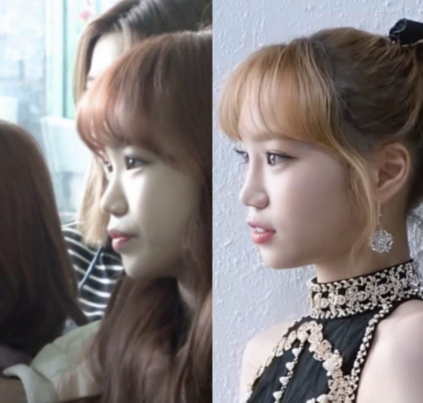 Kim Chaewon plastic surgeryface-comparison-beauty-korean-women.