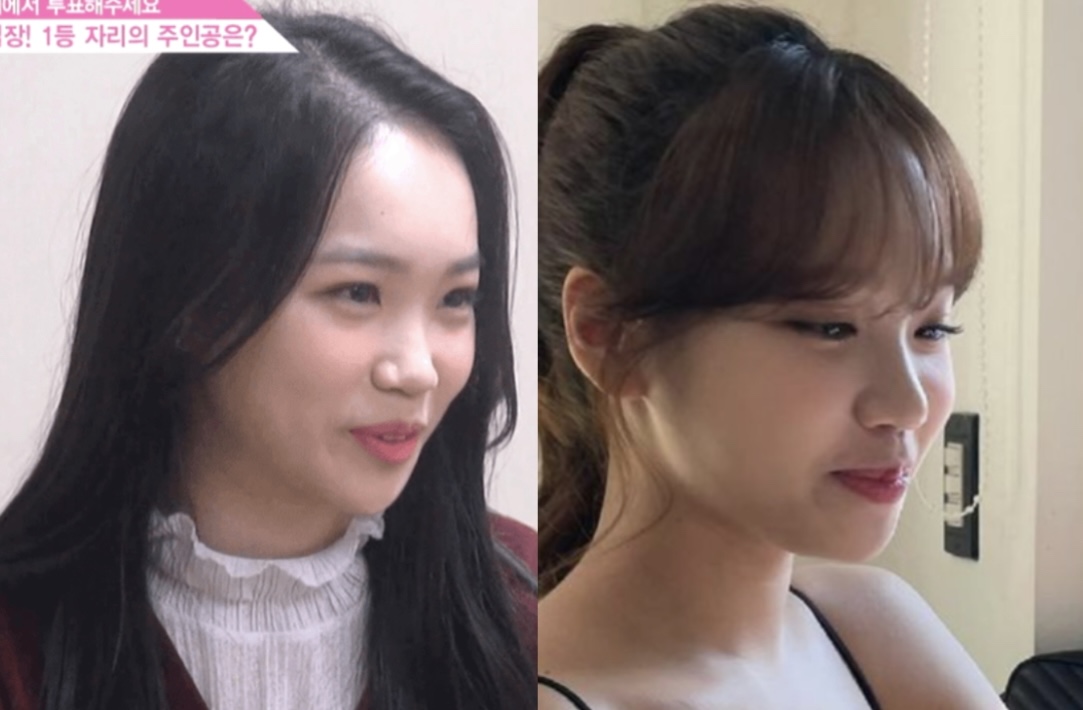 Kim Chaewon plastic surgerykorean-women-comparison-contestants-splitImage.