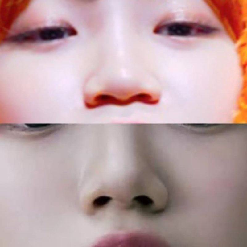 Kim Chaewon plastic surgeryface-comparison-eyes-nose-closeup.
