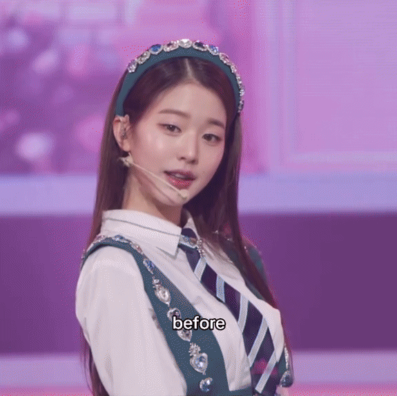 jang won-young lip-filler
