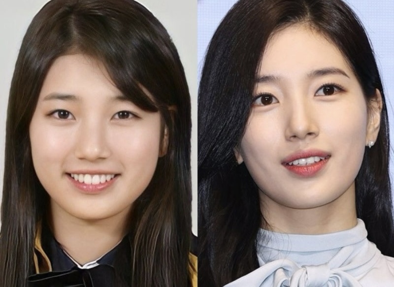 Suzy transformation