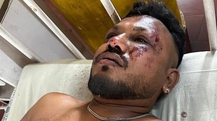 air india crash seat 11a survivalinjury-man-hospital-bruises.