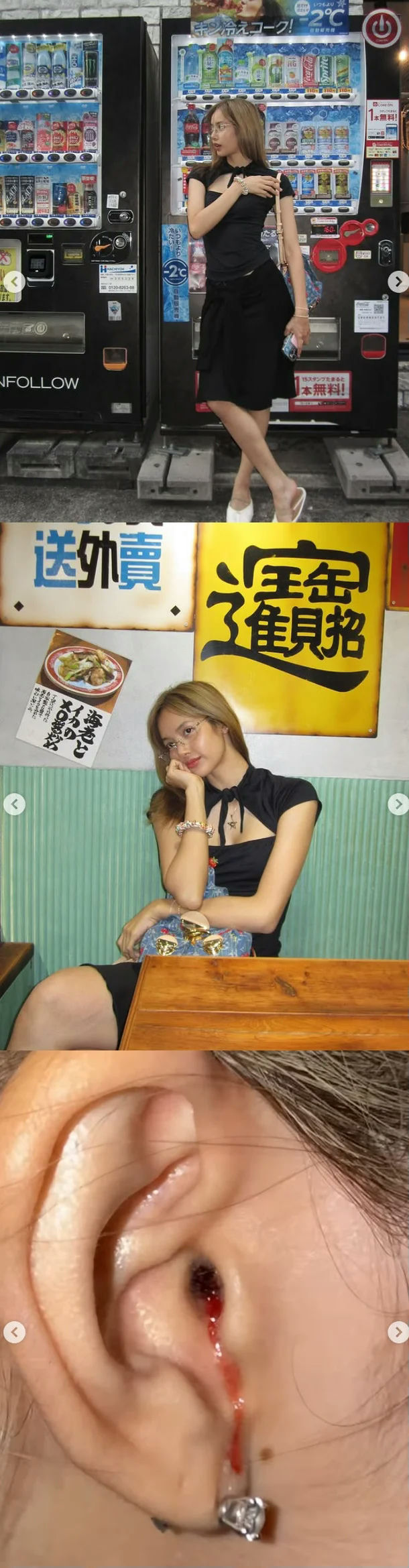 Lisa ear injuryvendingmachine-asianwoman-restaurant-bloodeardrum.