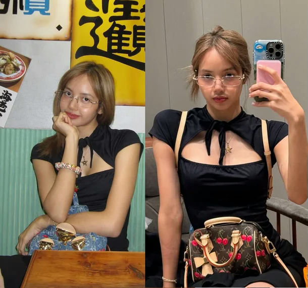 Lisa ear injuryLisa-glasses-blackdress-selfie.